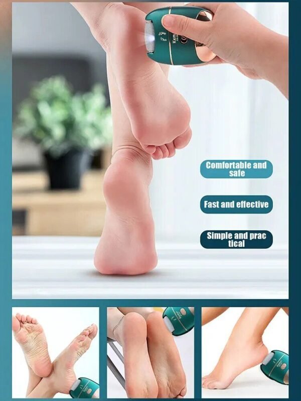 Rechargeable Electric Foot Callus Remover with 3 Grinding Rollers