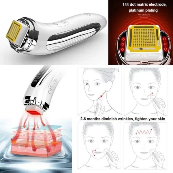 RF Radio Frequency Facial Rejuvenation Device: Dot Matrix Skin Tightening & Wrinkle Remover